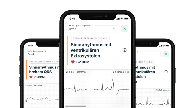 image of mobile devices showing the new Advanced Determinations feature as part of KardiaCare