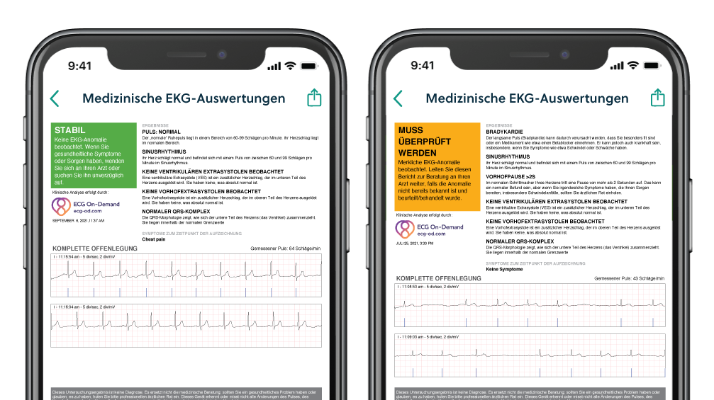 image of 2 phones with overread reports